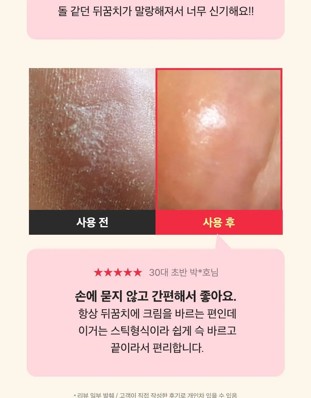 [데일리풋케어/맨들맨들아기발] 성분에디터 시어버터 베이비 풋 스틱 20g 2종 택 1 상세페이지 7